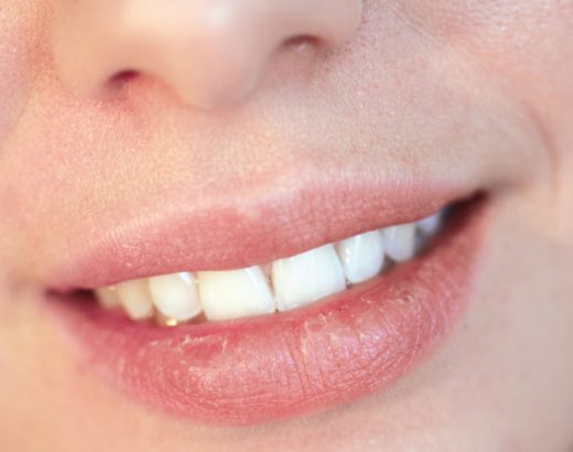 Winter Dry Lips Remedy